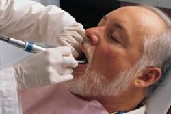 Finding Cheap Dental In Texas